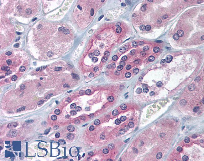 Anti-IGF2BP1 antibody IHC of human kidney. Immunohistochemistry of formalin-fixed, paraffin-embedded tissue after heat-induced antigen retrieval. Antibody LS-B1540 concentration 5 ug/ml.