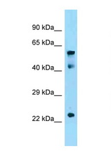IGF2BP1 antibody LS-C146368 Western blot of Mouse Thymus lysate. Antibody concentration 1 ug/ml.