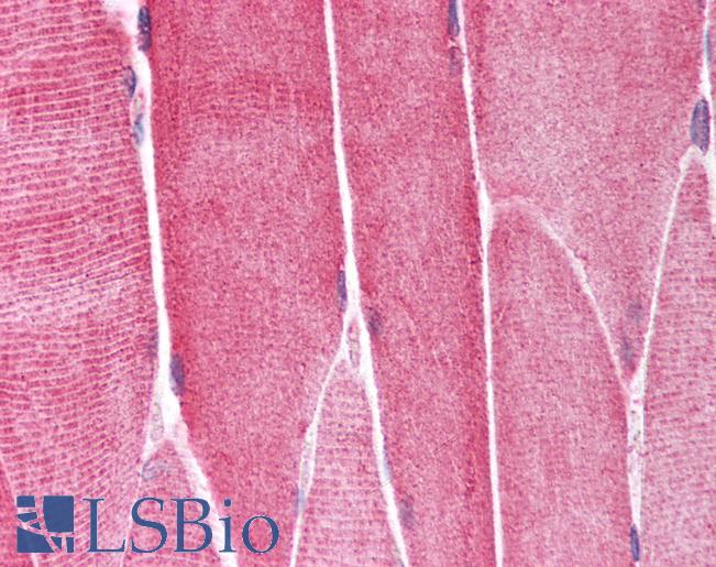 Anti-CHRNA1 antibody IHC of human skeletal muscle. Immunohistochemistry of formalin-fixed, paraffin-embedded tissue after heat-induced antigen retrieval. Antibody LS-B933 concentration 5 ug/ml.