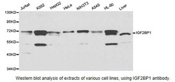 Western blot.
