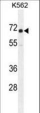 IGF2BP1 Antibody western blot of K562 cell line lysates (35 ug/lane). The IGF2BP1 antibody detected the IGF2BP1 protein (arrow).
