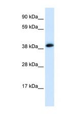 CHRNA1 antibody LS-B933 Western blot of Fetal Heart lysate. Antibody concentration 1 ug/ml.