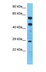Western blot of CHRNA10 Antibody with human 721_B Whole Cell lysate.