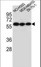 CHRNA10 Antibody western blot of NCI-H292,MDA-MB453,ZR-75-1 cell line lysates (35 ug/lane). The CHRNA10 antibody detected the CHRNA10 protein (arrow).