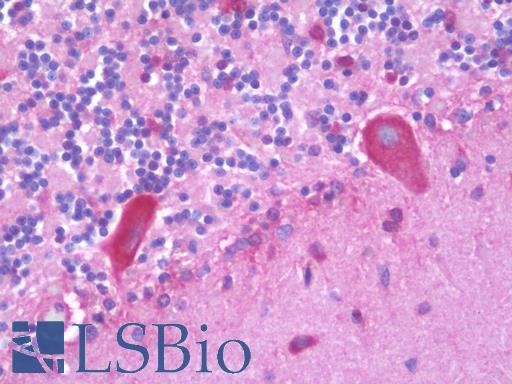 Anti-CHRNA10 antibody IHC staining of human brain, cerebellum. Immunohistochemistry of formalin-fixed, paraffin-embedded tissue after heat-induced antigen retrieval. Antibody LS-B9850 concentration 10 ug/ml.