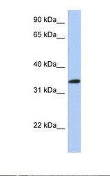Fetal brain lysate. Antibody concentration: 1.0 ug/ml. Gel concentration: 12%.