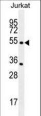 CHRNA2 Antibody western blot of Jurkat cell line lysates (35 ug/lane). The CHRNA2 antibody detected the CHRNA2 protein (arrow).