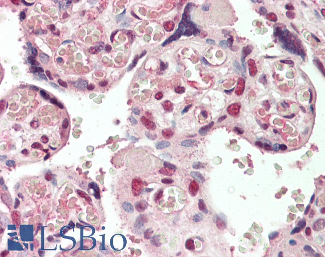 Anti-CREB3L2 / BBF2H7 antibody IHC staining of human placenta. Immunohistochemistry of formalin-fixed, paraffin-embedded tissue after heat-induced antigen retrieval. Antibody LS-B10572 concentration 5 ug/ml.