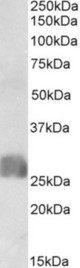 CREB3L2 antibody (1 ug/ml) staining of Human Placenta lysate (35 ug protein in RIPA buffer). Primary incubation was 1 hour. Detected by chemiluminescence.