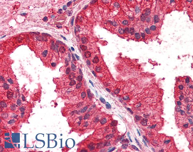 Anti-CREB3L4 antibody IHC of human prostate. Immunohistochemistry of formalin-fixed, paraffin-embedded tissue after heat-induced antigen retrieval. Antibody LS-B2272 concentration 5 ug/ml.