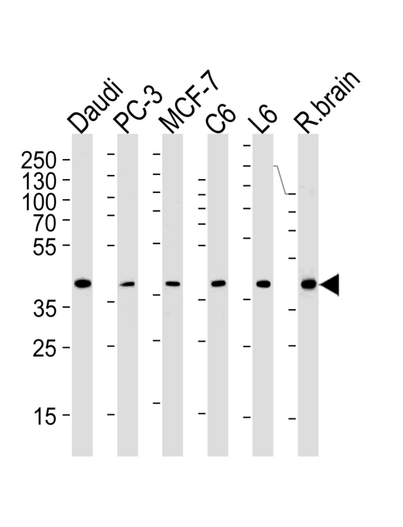 CREB3L4 Antibody (M01) western blot of Daudi, PC-3, MCF-7, rat C6 and L6 cell line , rat brain tissue lysates (35 ug/lane). The CREB3L4 (M01)antibody detected the CREB3L4 (M01)protein (arrow).