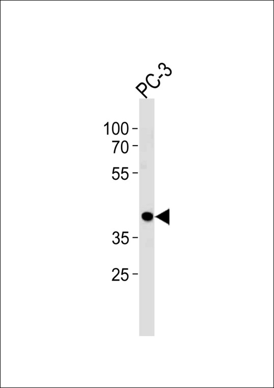 CREB3L4 Antibody western blot of PC-3 cell line lysates (35 ug/lane). The CREB3L4 antibody detected the CREB3L4 protein (arrow).