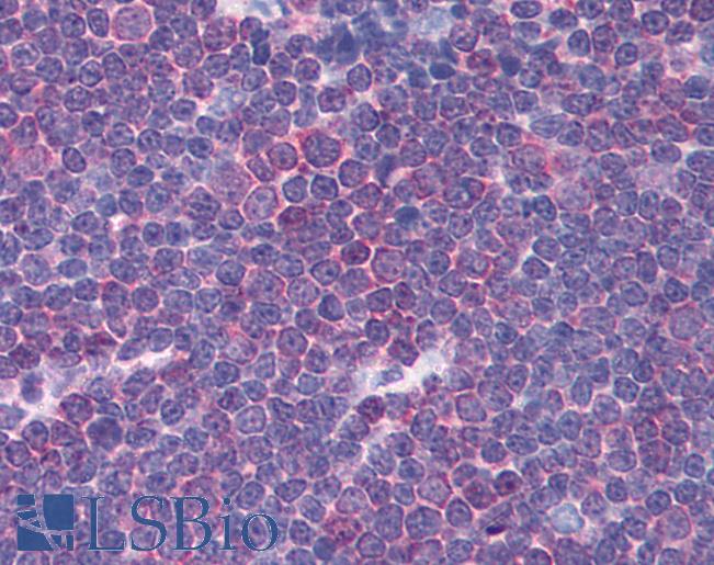 Anti-CHRNA3 antibody IHC of human thymus. Immunohistochemistry of formalin-fixed, paraffin-embedded tissue after heat-induced antigen retrieval. Antibody LS-B934 concentration 5 ug/ml.