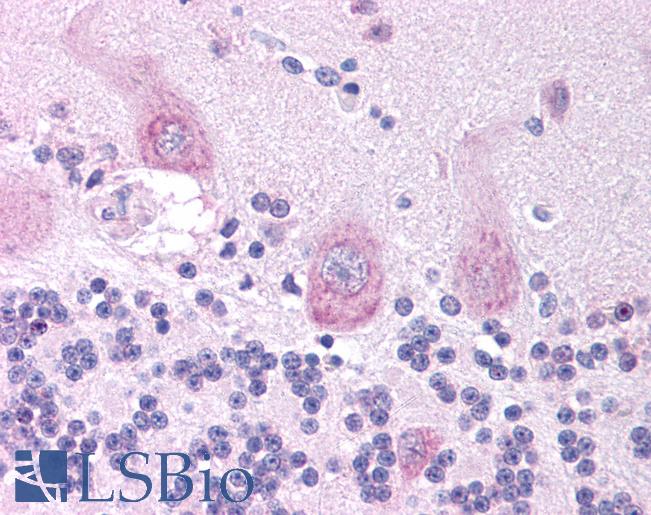 Anti-CHRNA3 antibody IHC of human brain, cerebellum. Immunohistochemistry of formalin-fixed, paraffin-embedded tissue after heat-induced antigen retrieval. Antibody LS-B934 concentration 5 ug/ml.