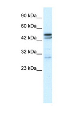 CHRNA3 antibody LS-B934 Western blot of Fetal Thymus lysate. Antibody concentration 1 ug/ml.