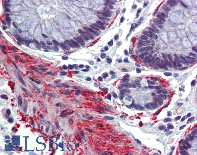 Anti-CREBBP antibody IHC of human colon. Immunohistochemistry of formalin-fixed, paraffin-embedded tissue after heat-induced antigen retrieval. Antibody LS-B4006 concentration 5 ug/ml.