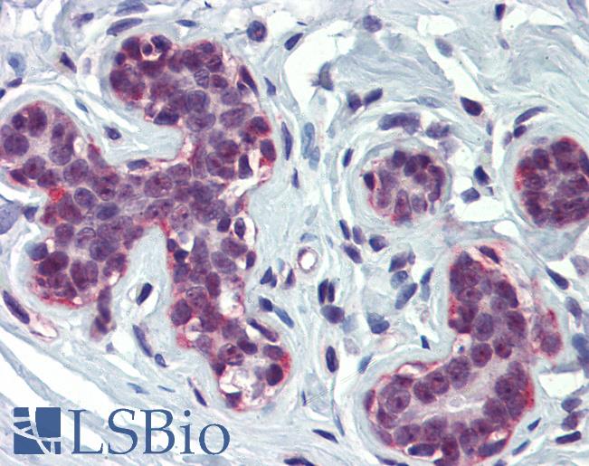 Anti-CREBBP antibody IHC of human breast. Immunohistochemistry of formalin-fixed, paraffin-embedded tissue after heat-induced antigen retrieval. Antibody LS-B4006 concentration 5 ug/ml.