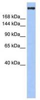Western analysis of Jurkat cell lysate.