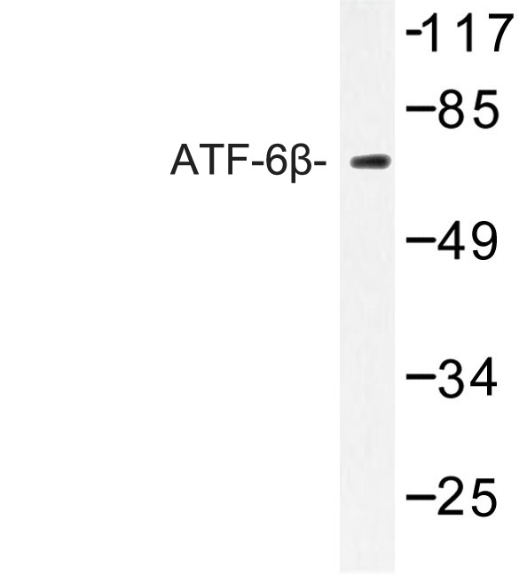 Western blot of ATF-6 (S425) pAb in extracts from COLO205 cells.