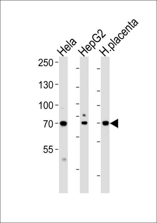 Western blot of lysates from HeLa, HepG2 cell line and human placenta tissue lysate (from left to right), using CREBL1Antibody. Antibody was diluted at 1:1000 at each lane. A goat anti-rabbit IgG H&L (HRP) at 1:5000 dilution was used as the secondary antibody. Lysates at 35ug per lane.