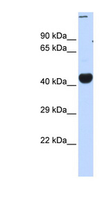 CREBZF antibody LS-C101589 Western blot of Fetal Muscle lysate.