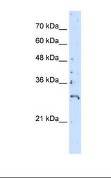 CCRF-CEM cell lysate. Antibody concentration: 5.0 ug/ml. Gel concentration: 12%.