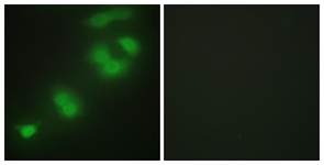 Immunofluorescence of HepG2 cells, using CREBZF Antibody. The picture on the right is treated with the synthesized peptide.