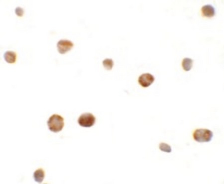 Immunocytochemistry of ZHANGFEI in K562 cells with ZHANGFEI antibody at 10 ug/ml.