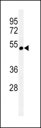Western blot of CHRNA3 Antibody in CEM cell line lysates (35 ug/lane). CHRNA3 (arrow) was detected using the purified antibody.