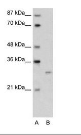 A: Marker, B: Transfected 293T Cell Lysate