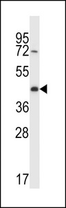CREG2 Antibody western blot of A2058 cell line lysates (35 ug/lane). The CREG2 antibody detected the CREG2 protein (arrow).