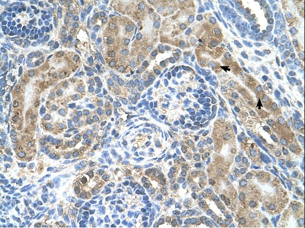 CRELD1 antibody LS-C80686 was used in IHC to stain formalin-fixed, paraffin-embedded human kidney.