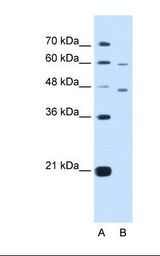 Lane A: Marker. Lane B: HepG2 cell lysate. Antibody concentration: 5.0 ug/ml. Gel concentration: 12%.
