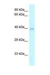 CRELD2 antibody LS-C145748 Western blot of Placenta lysate. Antibody concentration 1 ug/ml.