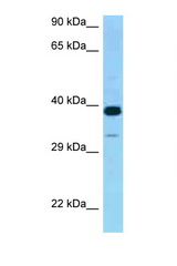 CRELD2 antibody LS-C146296 Western blot of 721_B Cell lysate. Antibody concentration 1 ug/ml.