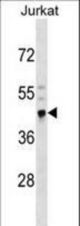 CRELD2 Antibody western blot of Jurkat cell line lysates (35 ug/lane). The CRELD2 antibody detected the CRELD2 protein (arrow).