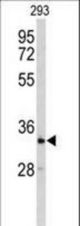Western blot of CRELD2 Antibody in 293 cell line lysates (35 ug/lane). CRELD2 (arrow) was detected using the purified antibody.