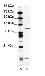 A: Marker, B: Jurkat Cell Lysate