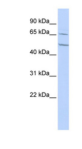 CHRNA4 antibody LS-C101526 Western blot of HepG2 cell lysate.