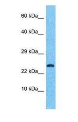 Western blot of CREM Antibody with human Fetal Kidney lysate.
