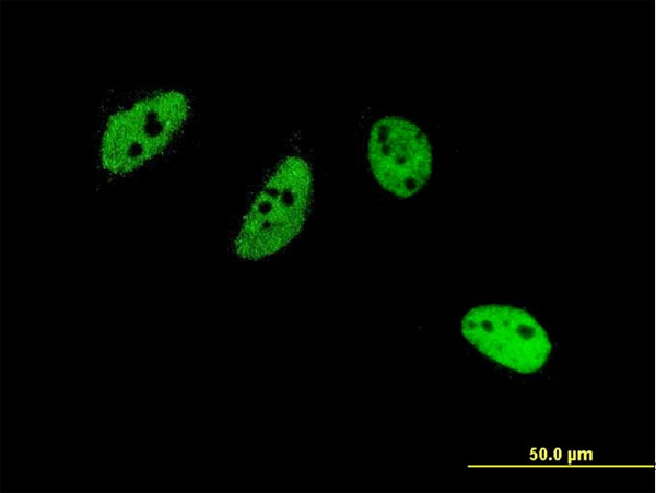 Immunofluorescence of monoclonal antibody to CREM on HeLa cell . [antibody concentration 10 ug/ml]