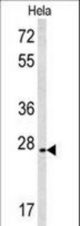Western blot of CREM Antibody in HeLa cell line lysates (35 ug/lane). CREM (arrow) was detected using the purified antibody.