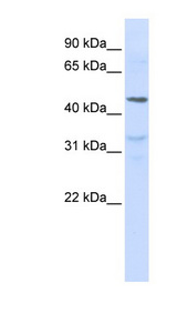 IL28RA antibody LS-C102285 Western blot of Jurkat lysate.