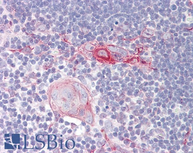 Anti-CRF2-12 / IL28RA antibody IHC of human thymus. Immunohistochemistry of formalin-fixed, paraffin-embedded tissue after heat-induced antigen retrieval. Antibody LS-B8186 dilution 2.5-5 ug/ml.