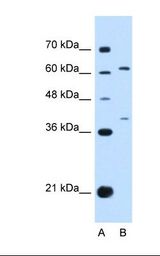 Lane A: Marker. Lane B: HepG2 cell lysate. Antibody concentration: 1.0 ug/ml. Gel concentration: 12%.