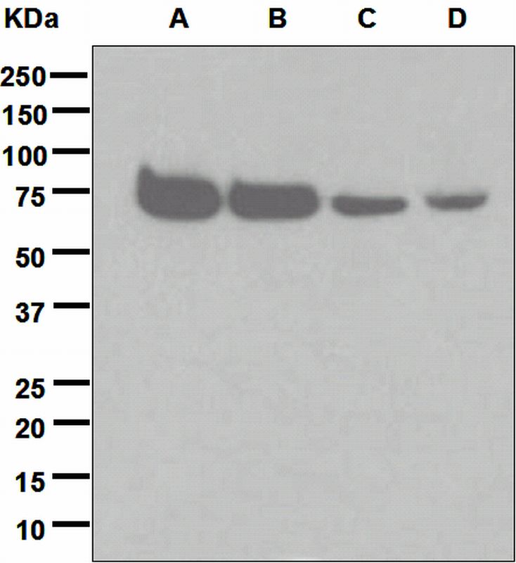 Western blot analysis on (A) SH-SY5Y, (B) A673, (C) C6, and (D) Neuro-2a cell lysates using anti-ACHR-alpha 4 antibody.