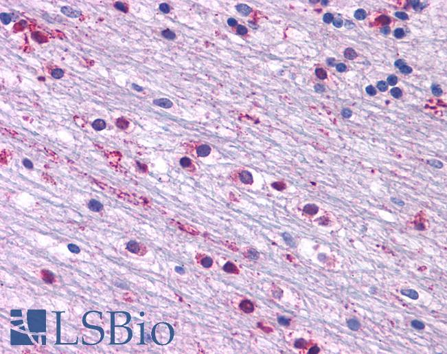 Anti-CRFR1 / CRHR1 antibody IHC of human brain, cerebellum glia. Immunohistochemistry of formalin-fixed, paraffin-embedded tissue after heat-induced antigen retrieval.