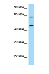 CRHR1 / CRF1 antibody LS-C146256 Western blot of HeLa Cell lysate. Antibody concentration 1 ug/ml.