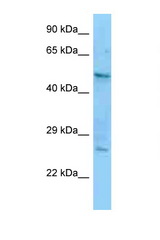 CRHR1 / CRF1 antibody LS-C146379 Western blot of A549 Cell lysate. Antibody concentration 1 ug/ml.