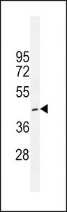 CRFR1 Antibody (Q103) western blot of K562 cell line lysates (35 ug/lane). The CRFR1 antibody detected the CRFR1 protein (arrow).